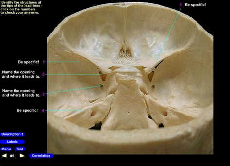 Middle Cranial Fossa Posterosuperior View 6 Diagram Quizlet