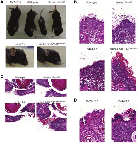 D4z4 25smchd1 Mommed1 Mice Develop Skin Hyperkeratosis And Alopecia