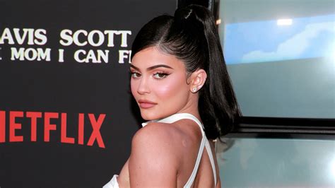 How Kylie Jenner Really Got The Large Scar On Her Leg