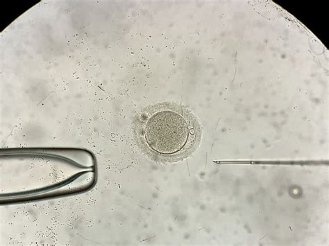 Visión A Través Del Microscopio En El Proceso De La Fertilización In