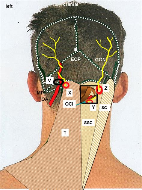 Greater Occipital Nerve And Artery