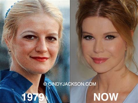 Woman With Most Plastic Surgery Done In The World Plastic Surgery Facts