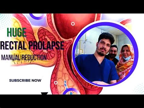 Huge Rectal Prolapse Manual Reduction Youtube