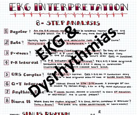 Ekg Interpretation And Dysrhythmias Etsy Sinus Tachycardia Ventricular