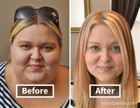Amazing Before After Pics Reveal How Weight Loss Affects Your Face