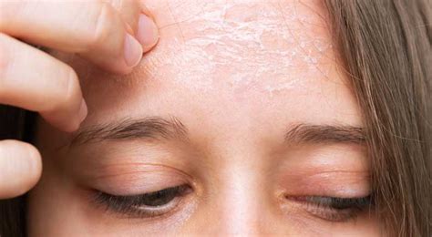 Caring For Sensitive Skin Causes Treatments Tips