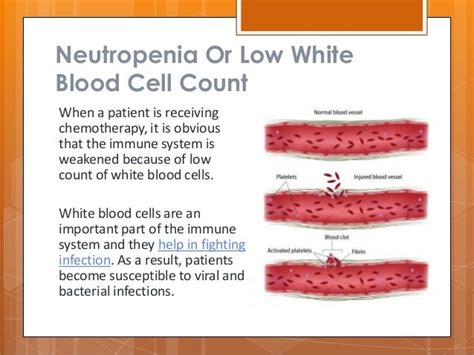 Low White Blood Cell Count Causes Adults Nordicsokolxu