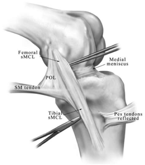 Knee Ligament Diagram Image Diagrams Sexiz Pix