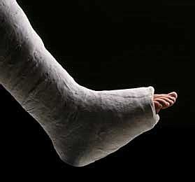 Ways for Breaking Your Legs on Purpose or Accidentally ...