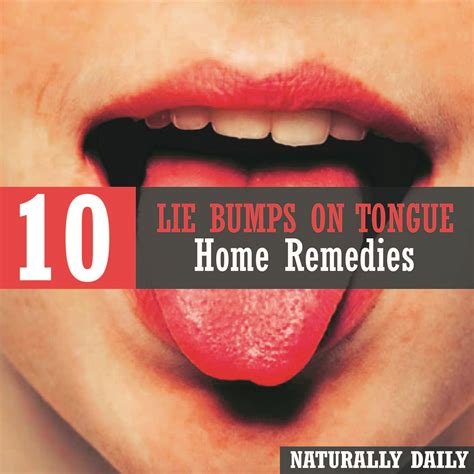 How To Get Rid Of Pimples On Tongue Belmiroeomundo