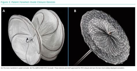 Patent Foramen Ovale Closure Devices Radcliffe Cardiology