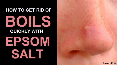 8 Effective Ways To Use Epsom Salt To Get Rid Of Boils Naturally