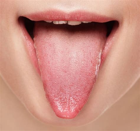 This Is What Your Tongue Has To Say About Your Health David Avocado