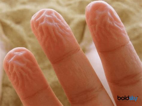 ಬರಳನಲಲ ನರಗ ಮಡದಯ ಇದ ಯವ ಕಯಲಗಳ ಲಕಷಣ Wrinkled on Fingers What Causes Wrinkled