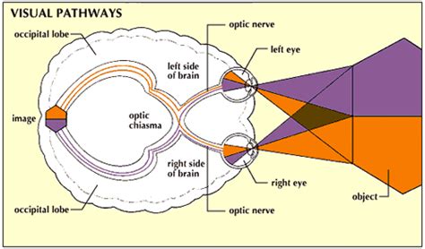 Strokehemianopsia Visionaware