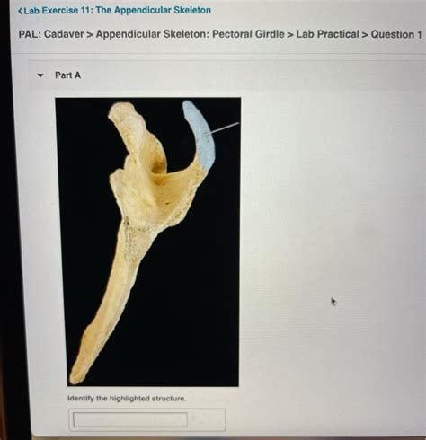 Solved Appendicular Skeleton Lower Limb Lab Practical