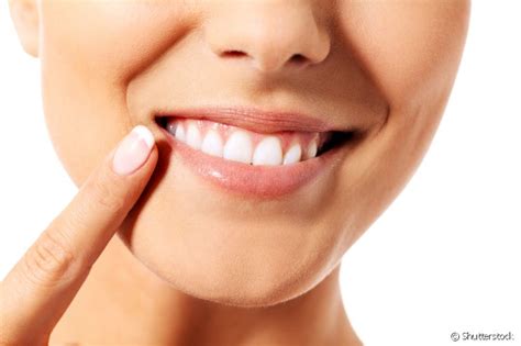 Como Os Dentes De Serrinhas Podem Ser Corrigidos Dentista Comenta O Melhor Procedimento Para