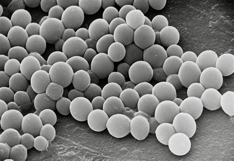 Sem Of Unidentified Yeast Cells Photograph By Microfield Scientific Ltd