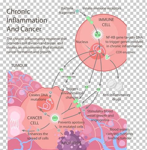 Cancer The Inflammation Free Diet Chronic Condition Health Png Clipart