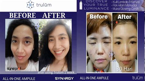 Trulum skin care (jujur tanpa rekayasa). Trulum Review - Harga Trulum Skincare Synergy Indonesia ...