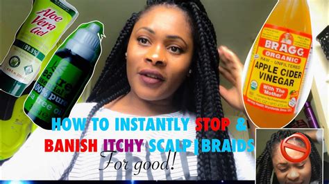 How To Instantly Stop And Banish Itchy Scalpbraids For Good ️ Youtube