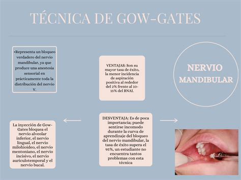 Pdf TÉcnica De Gow Gates Pdfslidenet