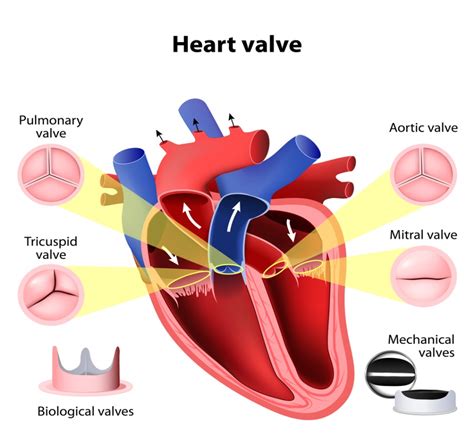 Mitral Valve Disorders • Victory Brokerage Inc Helping Agents Write
