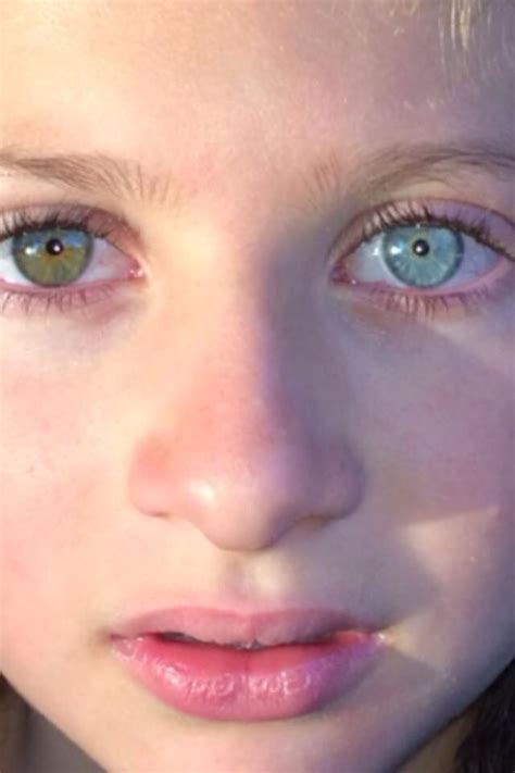 Stunning Heterochromia Eyes