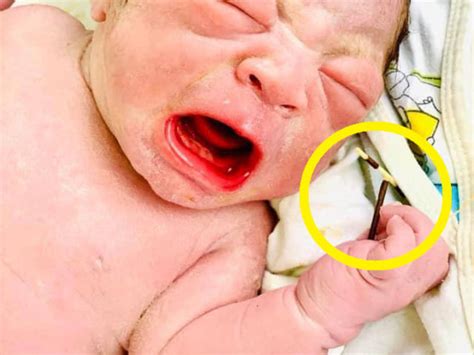 【画像】赤ちゃん、ママの子宮に装着された ”避妊具” を握り締め無事誕生 ポッカキット