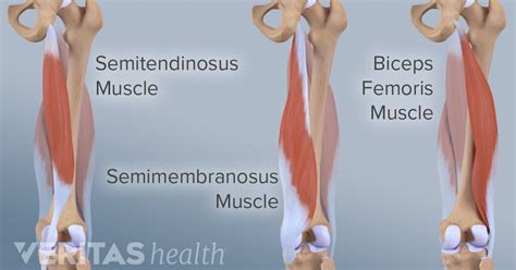(i) tendons from all four parts unite as common quadriceps tendon; Hamstrings - Not a new stadium food option - Bills Mafia ...