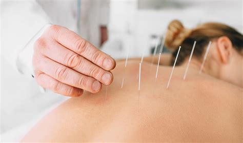 Could Acupunture Ease Your Back And Joint Pains My Weekly