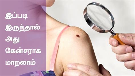 Common Cancer Symptoms And Signs Health Tips In Tamil Youtube