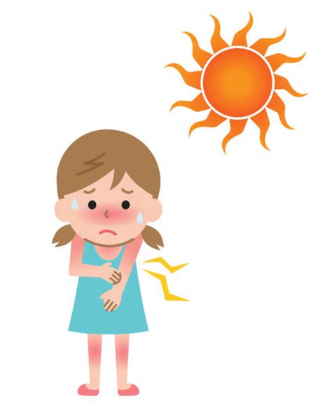 Cartoon Of Sunburn Illustrations Royalty Free Vector Graphics And Clip