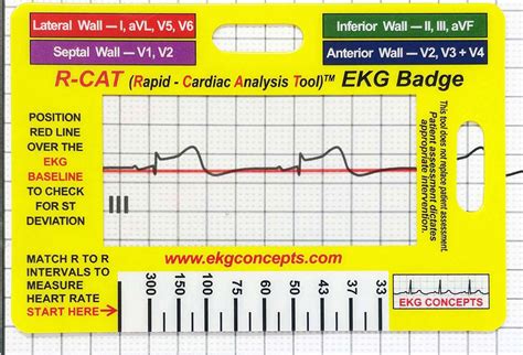 Buy R Cat Ekg Badge Card Accurately Interpret Ecg Ekg Rhythm Strips