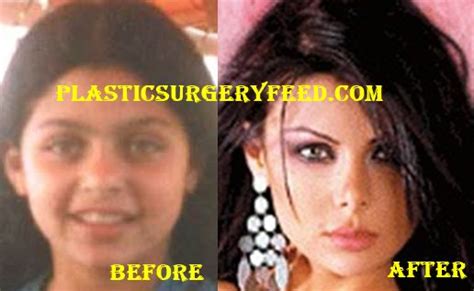 Haifa Wehbe Plastic Surgery Plastic Surgery Feed
