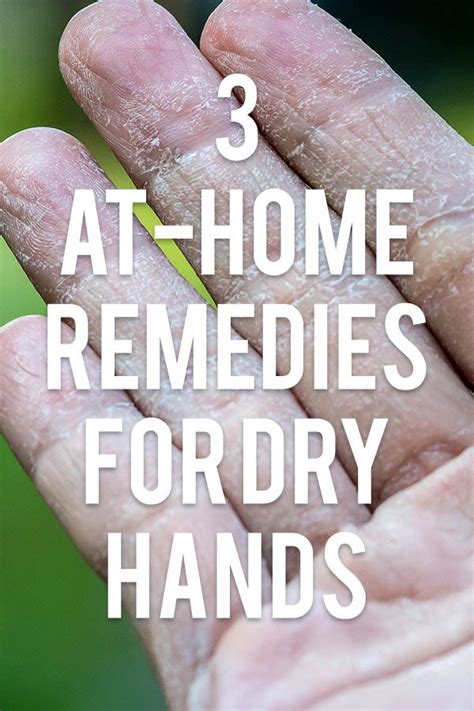 nothing is worse than rough dry cracked hands and when winter hits like it inevitably and