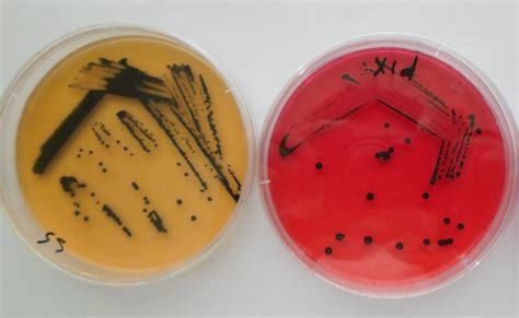 Typical Salmonella Colonies On Salmonella Shigella Agar And