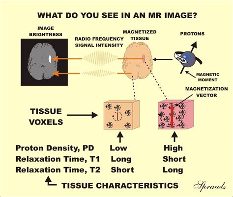 Magnetic Resonance Image Characteristics