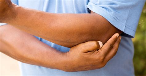 Gout In Elbow What You Need To Know About Elbow Gout