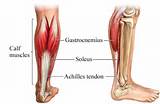 Pulled Calf Muscle Exercises