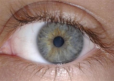 Iris Anatomy Wikipedia The Free Encyclopedia Rare Eye Colors