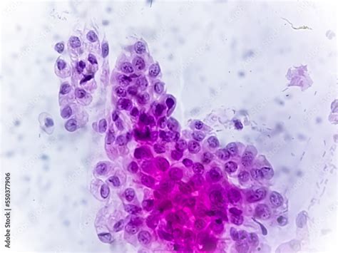 Foto Stock Microscopic View Of Trichomonas Vaginalis In Pap Smear With