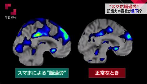 “スマホ脳過労” 記憶力や意欲が低下！？ Nhk クローズアップ現代＋