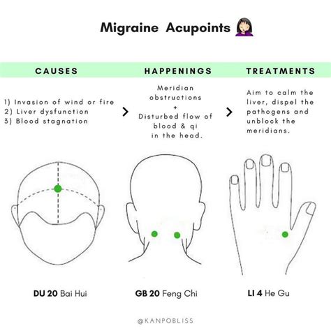 “press These Acupoints For Migraine Or Headache 1 3minutes Everyday” Tcm Acupuncture