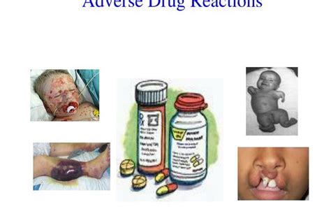 The 5 Types Of Adverse Drug Reactions Adrs Meds Safety