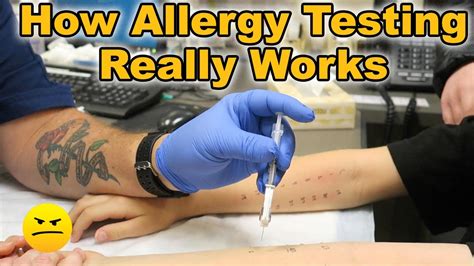 How Testing For Allergies Really Works Youtube