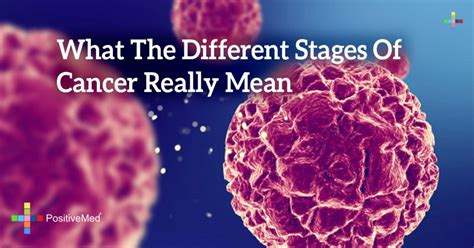 What The Different Stages Of Cancer Really Mean