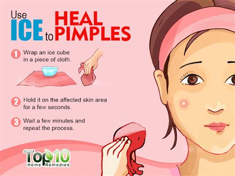Best Ways To Get Rid Of Pimples At Home