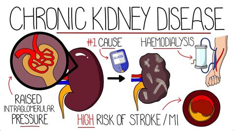 Understanding Chronic Kidney Disease Ckd Youtube