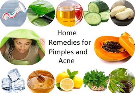 6 Best Home Remedies For Pimples And Acne Theallmag
